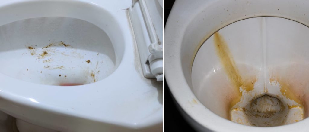 How To Clean Poop Stains From Toilet Bowl