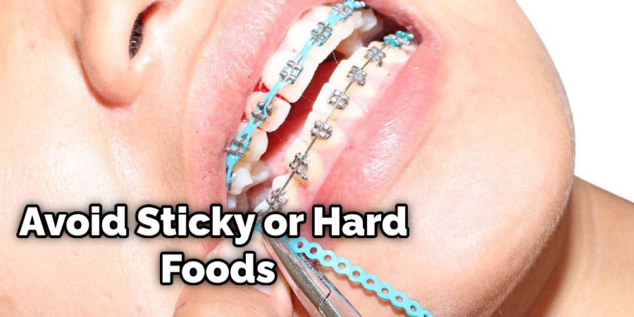How To Remove Braces At Home