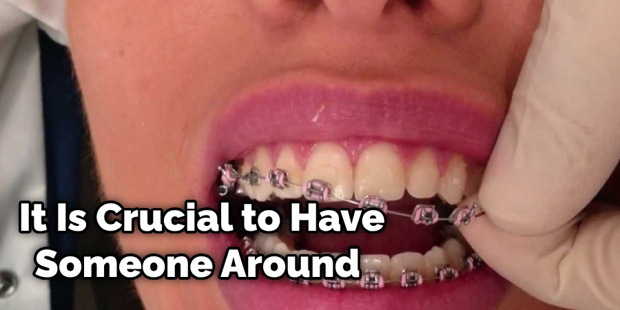 How To Remove Braces At Home