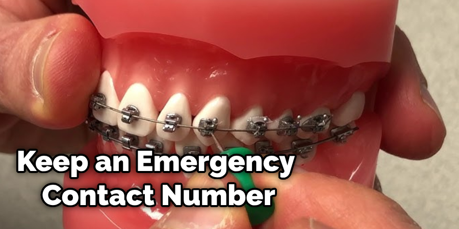 How To Remove Braces At Home